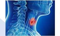 اختلالات تیروئیدی از منظر غذا و دارو